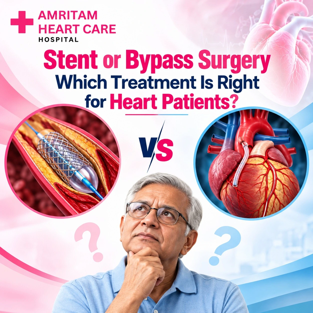 Stent or Bypass Surgery Which Treatment Is Right for Heart Patients?